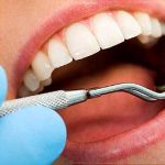 Dental Implements