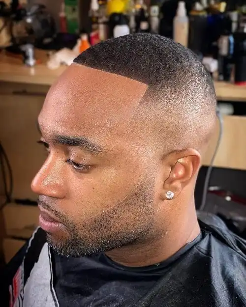 Little Skin Loss Buzz Cut